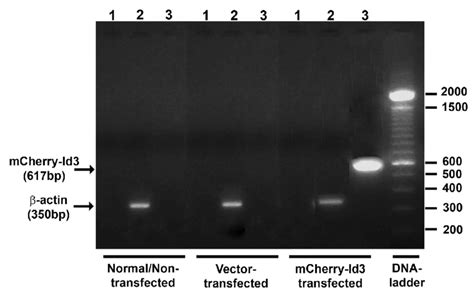 Agarose Gel Electrophoresis Showing Successful Delivery Of The