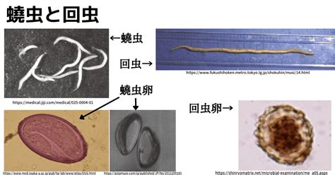 寄生虫18種の中間宿主感染経路ポイントの覚え方ゴロ総まとめ ゴロゴロ医学