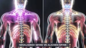 How Does a Chiropractic Adjustment Work? | Chiro One