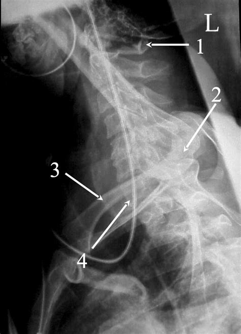 Cervicothoracic T Spine Diagram Quizlet