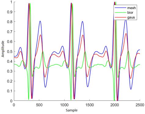 Reconstructed Ecg Signal Using Wavelet Thresholding Method Over