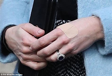 Kate Middleton S Catalogue Of Injuries To Her Perfectly Manicured Fingers Daily Mail Online