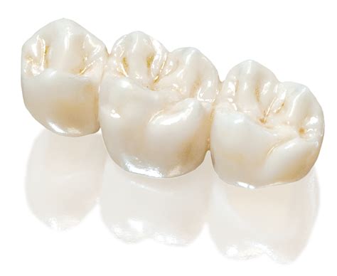 SunCeram Restorations Zirconia Dental Crowns Sun Dental Labs