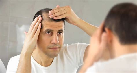 What Causes Hair Loss A Look At The 13 Most Common Factors