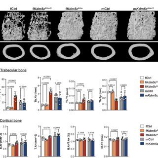 Increased Trabecular Bone Mass And Impaired Osteoclastogenesis In