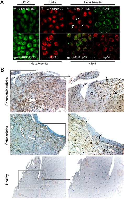 Localisation And Expression Of Cytokine Regulated Stress Granule