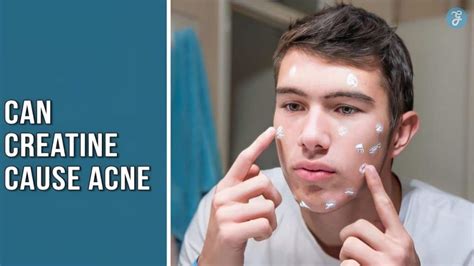 Can Creatine Cause Acne 10 Surprising Side Effects