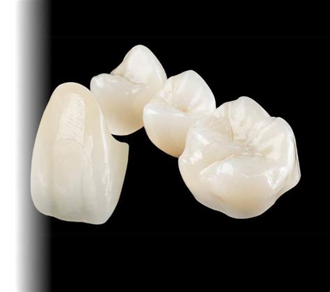 What Emax And Zirconia Crowns Are Dental Excellence Turkey Blog