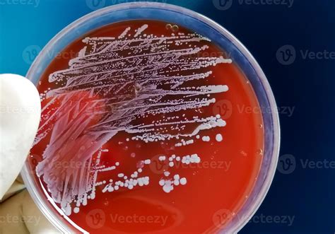 Staphylococcus aureus, Gram positive, to Gram variable, nonmotile ...