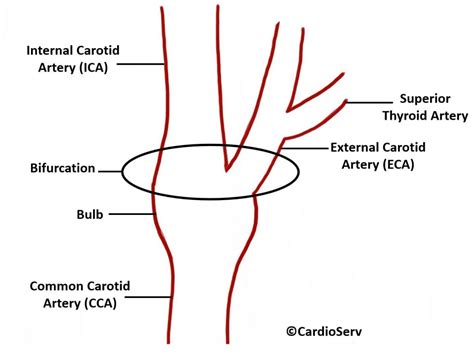 Carotid Artery Anatomy Cardioserv