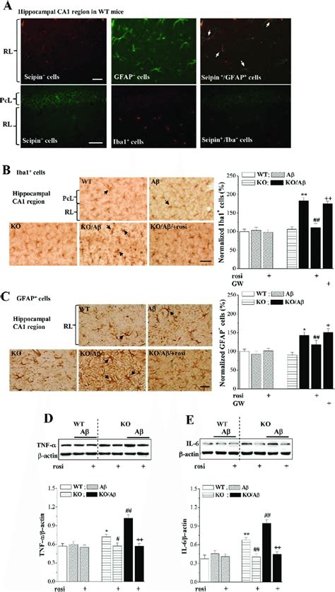 Activation Of Pparγ Reduces The Enhanced Aβ Induced Inflammation By