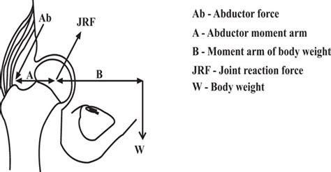 Basic Science Considerations In Primary Total Hip Replacement Arthroplasty