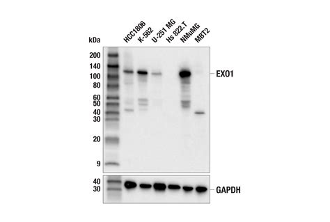 Mismatch DNA Repair MMR Antibody Sampler Kit Cell Signaling Technology