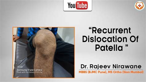 Recurrent Patellar Dislocation Youtube