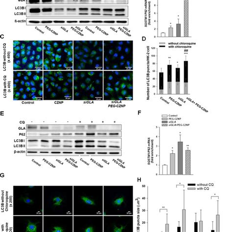 Effects Of Peg Cznps On The Autophagy Response In Hk Cells And In The