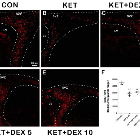 The Effects Of Ketamine And Dexmedetomidine DEX On The Proliferation