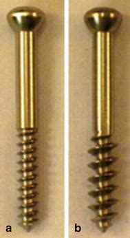 The Tested Bone Screws Cortical A And Cancellous B Bone Screws