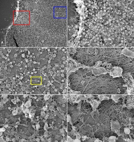 The Ultrastructural Organization Of Actin And Myosin Ii Filaments In