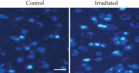 Hucb Mscs Can Rescue The Function Of Irradiated Osteogenic Precursor