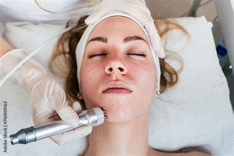 Young Woman Receiving Modern Radio Frequency Face Tightening Treatment