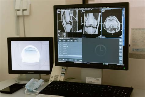 Osteopenia O Que é Sintomas Tratamentos E Causas Blog Da Saúde