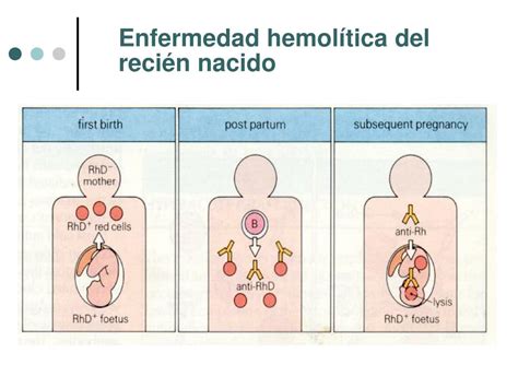 Ppt Inmunopatolog A De La Hipersensibilidad Tipo I Powerpoint