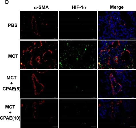 Hif Alpha Antibody H Alpha Nb Novus Biologicals