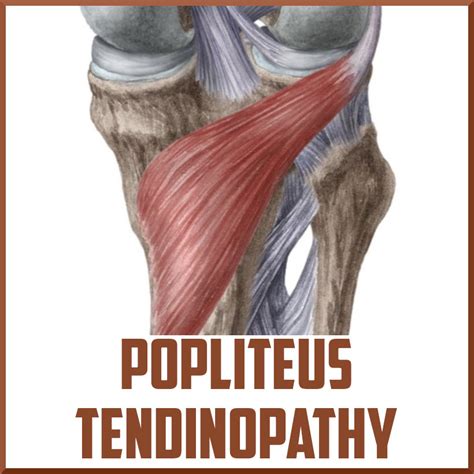 Popliteus Tendon | Hot Sex Picture