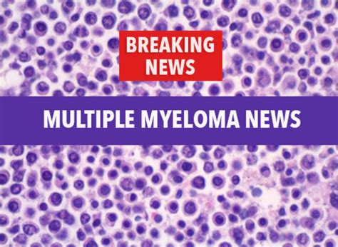 Treatment of Relapsed Myeloma with Second Stem Cell Transplant Appears ...