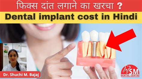 Dental Implants Full Set Of Teeth Cost Full Mouth Dental Implants