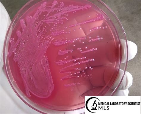 E Coli On Blood Agar