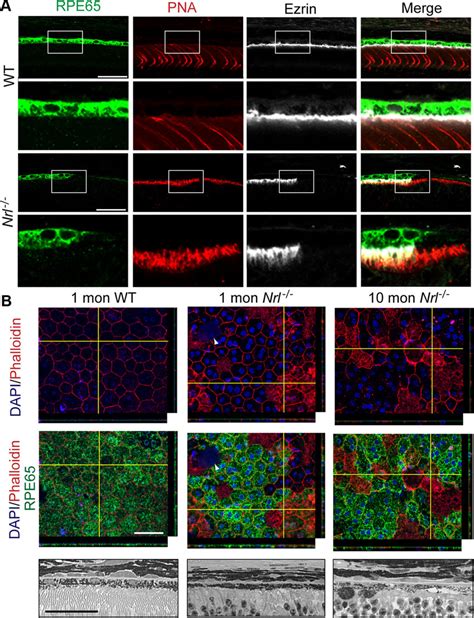 Changes In Rpe In Nrl Retina A Immunolabeling On Vibratome Sections