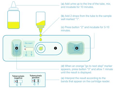 JCM Free Full Text Fujifilm SILVAMP TB LAM For The Diagnosis Of