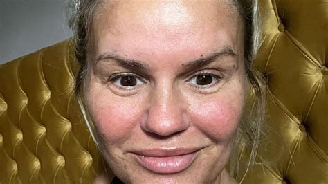 Extreme Schmerzen Bereut Kerry Katona Ihre Beauty OP