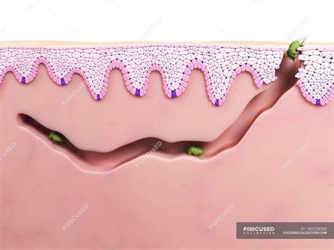 Scabies Mites Burrowing Into The Skin — Cross Section Parasite Stock