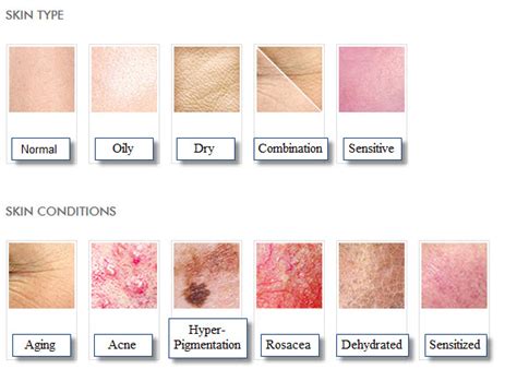 All Types Of Skin Rashes