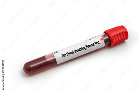 Tsh Thyroid Stimulating Hormone Test Medical Check Up Test Tube With