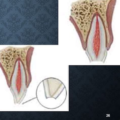 Endo Final Master Set Flashcards Quizlet