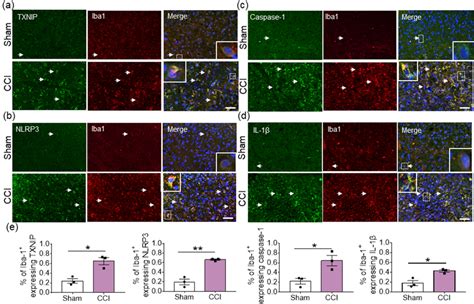 Cellular localization of TXNIP a NLRP3 b caspase 1 c and IL 1β