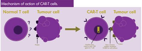 Car T Therapy For Non Hodgkin Lymphoma