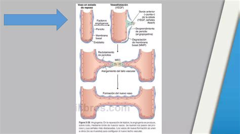 Inflamacion granulomatosa Patología PPT