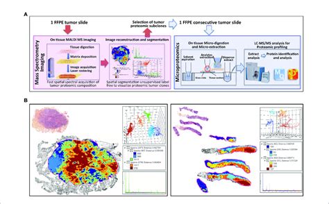 Clonal Proteome Analysis In Breast Cancer A Workflow For On Tissue