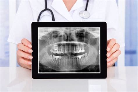 Best Place For Dental X Ray In Cranston Ri Contact Us