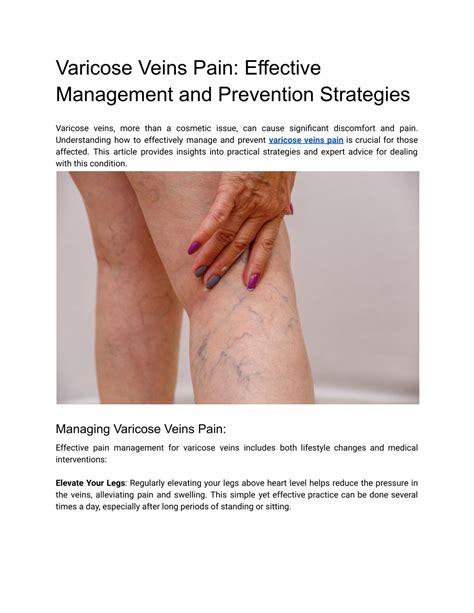 PPT Varicose Veins Pain Effective Management And Prevention