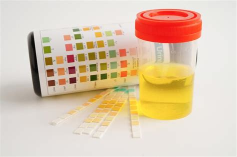 Premium Photo Urinalysis Urine Cup With Reagent Strip Ph Paper Test