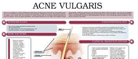 Acne Vulgaris – Anejo