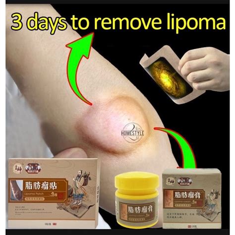 Cured Lipoma Removal Patch Special Gel Removing Multiple Single Lipoma