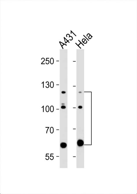 Abl Antibody Purified Mouse Monoclonal Antibody Mab Wb Ihc P E