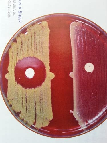 Bacitracin Sensitivity Test Flashcards Quizlet