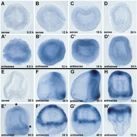 Spatial Expression Patterns Of Sphnf Mrna At Different Time Points In